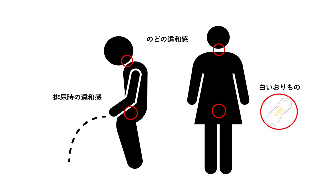 性器クラミジア感染症症状