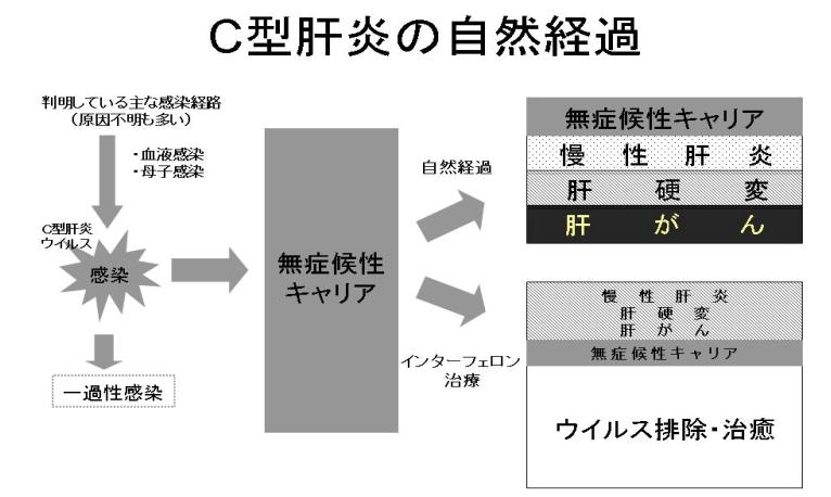 厚生労働省 ウイルス肝炎について 一般向け