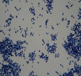 corynebacterium