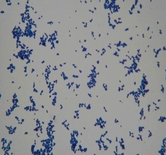 corynebacterium