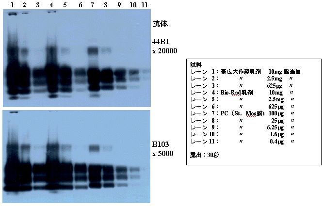 摜FR 44B1 x 20000,B103 x 5000