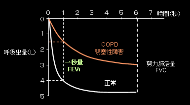 COPD̐ffǐQ̌o@bFEV1 / FVC < VO%̃Ot