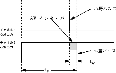 3JH00000001579.jpg