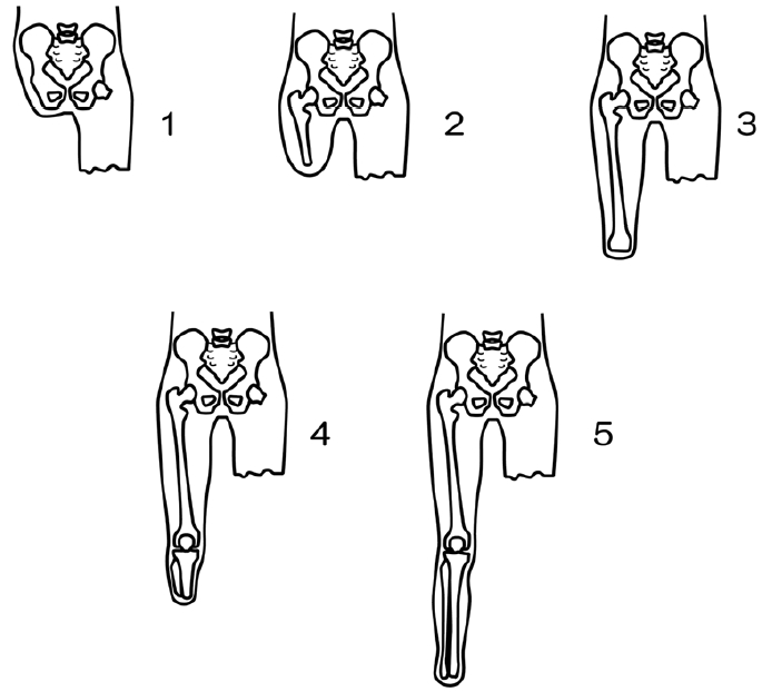 3JH00000003196.jpg
