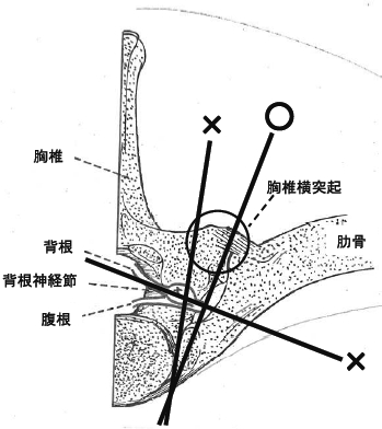 3JH00000005878.jpg