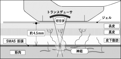 2JH00000232982.jpg