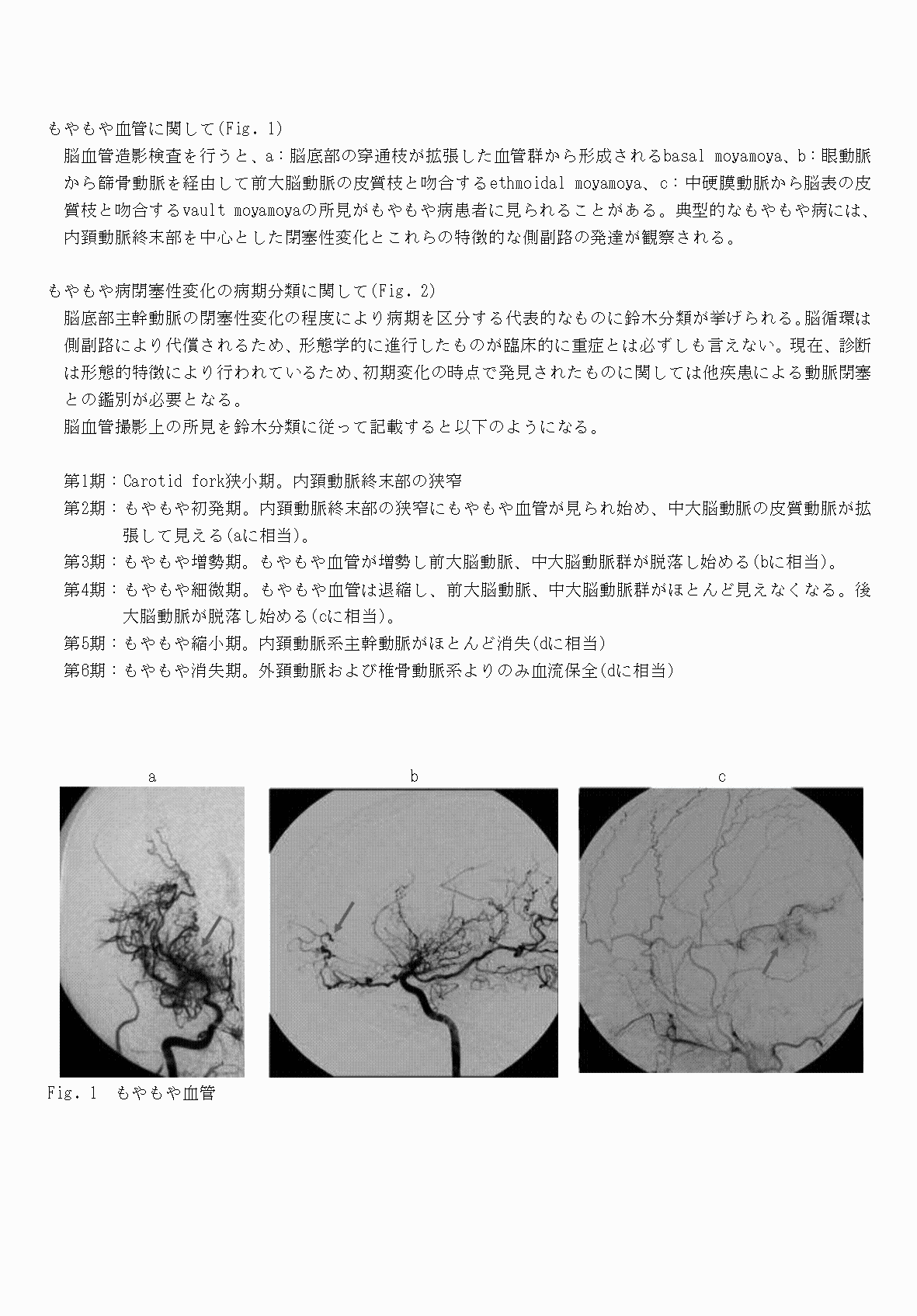 2FH00000069801-5.png