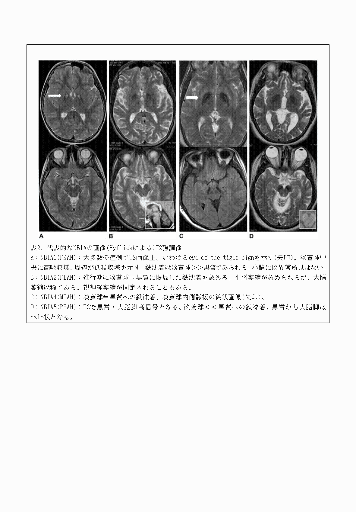 2FH00000070628-4.png