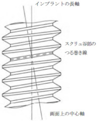 2JH00000228166.jpg